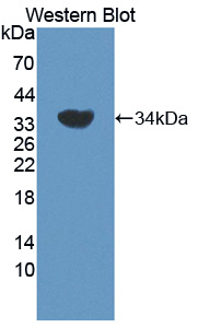RYK Antibody - Western blot of RYK antibody.