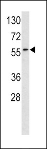 RYK Antibody - Western blot of RYK antibody (Center C397) in HeLa cell line lysates (35 ug/lane). RYK (arrow) was detected using the purified antibody.