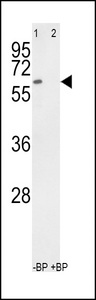 RYK Antibody - Western blot of anti-hRYK-W576 antibody pre-incubated without(lane 1) and with(lane 2) blocking peptide in 293 cell line lysate. hRYK-W576(arrow) was detected using the purified antibody.