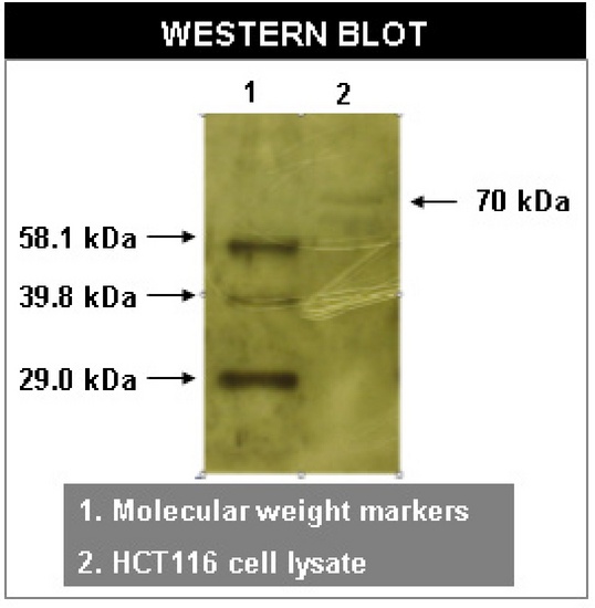 RYK Antibody - Western blot of RYK antibody (Receptor-Like Tyrosine Kinase) on HCT116 cell lysates.
