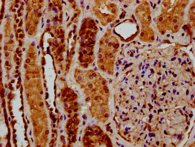 RYK Antibody - Immunohistochemistry Dilution at 1:200 and staining in paraffin-embedded human kidney tissue performed on a Leica BondTM system. After dewaxing and hydration, antigen retrieval was mediated by high pressure in a citrate buffer (pH 6.0). Section was blocked with 10% normal Goat serum 30min at RT. Then primary antibody (1% BSA) was incubated at 4°C overnight. The primary is detected by a biotinylated Secondary antibody and visualized using an HRP conjugated SP system.