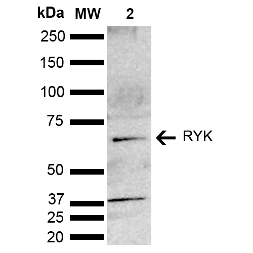 RYK Antibody - Western blot analysis of Mouse brain lysate showing detection of ~67.5 kDa RYK protein using Rabbit Anti-RYK Polyclonal Antibody. Lane 1: Molecular Weight Ladder (MW). Lane 2: Mouse brain lysate. Load: 15 µg. Block: 5% Skim Milk in TBST. Primary Antibody: Rabbit Anti-RYK Polyclonal Antibody  at 1:1000 for 2 hours at RT. Secondary Antibody: Goat Anti-Rabbit HRP:IgG at 1:4000 for 1 hour at RT. Color Development: ECL solution for 5 min at RT. Predicted/Observed Size: ~67.5 kDa. Other Band(s): ~37 kDa degradation product.