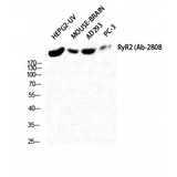 RYR2 / Ryanodine Receptor 2 Antibody - Western blot of RyR-2 antibody