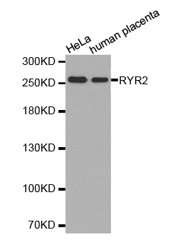 RYR2 / Ryanodine Receptor 2 Antibody - Western blot analysis of HeLa cell and human placenta cell lysate using RYR2 antibody.