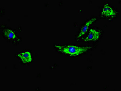 RYR2 / Ryanodine Receptor 2 Antibody - Immunofluorescent analysis of Hela cells diluted at 1:100 and Alexa Fluor 488-congugated AffiniPure Goat Anti-Rabbit IgG(H+L)
