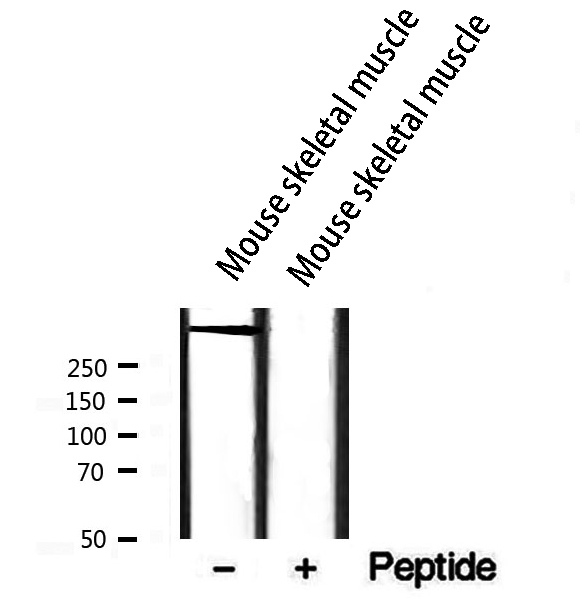 RYR2 / Ryanodine Receptor 2 Antibody - Western blot analysis of extracts of mouse skeletal muscle using RYR2 antibody. The lane on the right is treated with the antigen-specific peptide.