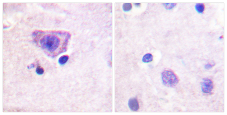 RYR2 / Ryanodine Receptor 2 Antibody - Immunohistochemistry analysis of paraffin-embedded human brain, using RyR2 (Phospho-Ser2808) Antibody. The picture on the right is blocked with the phospho peptide.