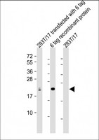 S1 Tag Antibody - All lanes: Anti-S1 tag Antibody Antibody at 1:2000 dilution Lane 1: 293T/17 transfected with 6 tag lysate Lane 2: 6 tag recombinant protein lysate Lane 3: 293T/17 whole cell lysate Lysates/proteins at 20 µg per lane. Secondary Goat Anti-Rabbit IgG, (H+L), Peroxidase conjugated at 1/10000 dilution. Predicted band size: 24 kDa Blocking/Dilution buffer: 5% NFDM/TBST.