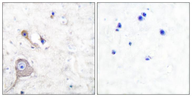 S100 Protein Antibody - Peptide - + Immunohistochemical analysis of paraffin-embedded human brain tissue using S100 A1 antibody.