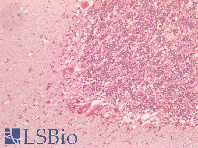 S100 Protein Antibody - Human Brain, Cerebellum: Formalin-Fixed, Paraffin-Embedded (FFPE)