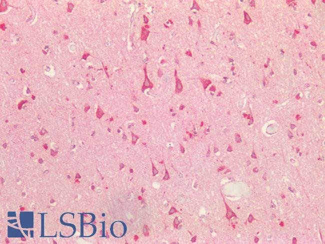 S100 Protein Antibody - Human Brain, Cortex: Formalin-Fixed, Paraffin-Embedded (FFPE)