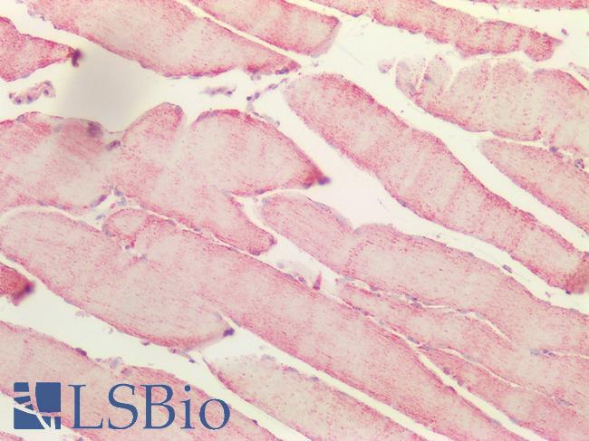 S100 Protein Antibody - Human Skeletal Muscle: Formalin-Fixed, Paraffin-Embedded (FFPE)