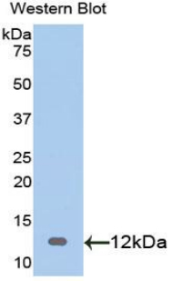 S100A1 / S100-A1 Antibody - Western blot of recombinant S100A1 / S100.  This image was taken for the unconjugated form of this product. Other forms have not been tested.