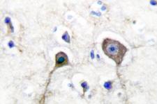 S100A1 / S100-A1 Antibody - IHC of S100 A1 (A18) pAb in paraffin-embedded human brain tissue.