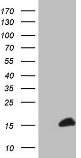 S100A1 / S100-A1 Antibody - HEK293T cells were transfected with the pCMV6-ENTRY control. (Left lane) or pCMV6-ENTRY S100A1. (Right lane) cDNA for 48 hrs and lysed. Equivalent amounts of cell lysates. (5 ug per lane) were separated by SDS-PAGE and immunoblotted with anti-S100A1.