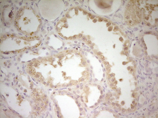 S100A1 / S100-A1 Antibody - Immunohistochemical staining of paraffin-embedded Human Kidney tissue within the normal limits using anti-S100A1 mouse monoclonal antibody. (Heat-induced epitope retrieval by 1 mM EDTA in 10mM Tris, pH8.5, 120C for 3min,