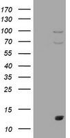 S100A1 / S100-A1 Antibody - HEK293T cells were transfected with the pCMV6-ENTRY control (Left lane) or pCMV6-ENTRY S100A1 (Right lane) cDNA for 48 hrs and lysed. Equivalent amounts of cell lysates (5 ug per lane) were separated by SDS-PAGE and immunoblotted with anti-S100A1.