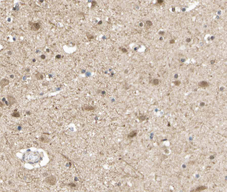 S100A1 / S100-A1 Antibody - 1:100 staining human brain tissue by IHC-P. The tissue was formaldehyde fixed and a heat mediated antigen retrieval step in citrate buffer was performed. The tissue was then blocked and incubated with the antibody for 1.5 hours at 22°C. An HRP conjugated goat anti-rabbit antibody was used as the secondary.