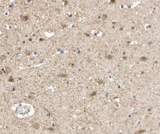 S100A1 / S100-A1 Antibody - 1:100 staining human brain tissue by IHC-P. The tissue was formaldehyde fixed and a heat mediated antigen retrieval step in citrate buffer was performed. The tissue was then blocked and incubated with the antibody for 1.5 hours at 22°C. An HRP conjugated goat anti-rabbit antibody was used as the secondary.