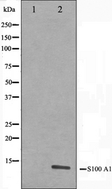 S100A1 / S100-A1 Antibody - Western blot analysis on A549 cell lysates using S100 A1 antibody. The lane on the left is treated with the antigen-specific peptide.