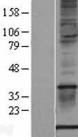 S100A1 / S100-A1 Protein - Western validation with an anti-DDK antibody * L: Control HEK293 lysate R: Over-expression lysate
