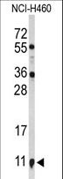 S100A10 Antibody - Western blot of S100A10 Antibody in NCI-H460 cell line lysates (35 ug/lane). S100A10 (arrow) was detected using the purified antibody.