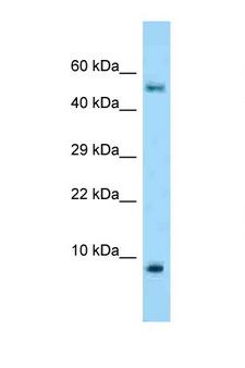 S100A10 Antibody - S100A10 antibody Western blot of Fetal Lung lysate. Antibody concentration 1 ug/ml.  This image was taken for the unconjugated form of this product. Other forms have not been tested.