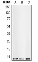 S100A10 Antibody - Western blot analysis of S100-A10 expression in HT29 (A); HeLa (B); A431 (C) whole cell lysates.