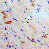S100A10 Antibody - Immunohistochemical analysis of S100-A10 staining in human brain formalin fixed paraffin embedded tissue section. The section was pre-treated using heat mediated antigen retrieval with sodium citrate buffer (pH 6.0). The section was then incubated with the antibody at room temperature and detected using an HRP conjugated compact polymer system. DAB was used as the chromogen. The section was then counterstained with hematoxylin and mounted with DPX.