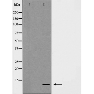 S100A10 Antibody - Western blot of S100 A10 expression in COLO cells