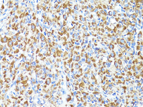 S100A10 Antibody - Immunohistochemistry of paraffin-embedded rat ovary using S100A10 antibody at dilution of 1:100 (40x lens).