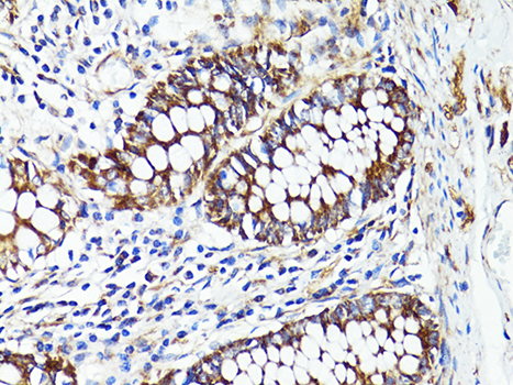 S100A10 Antibody - Immunohistochemistry of paraffin-embedded human colon using S100A10 antibody at dilution of 1:100 (40x lens).