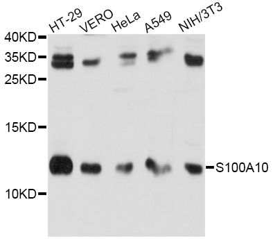 S100A10 Antibody - Western blot analysis of extracts of various cell lines, using S100A10 antibody at 1:1000 dilution. The secondary antibody used was an HRP Goat Anti-Rabbit IgG (H+L) at 1:10000 dilution. Lysates were loaded 25ug per lane and 3% nonfat dry milk in TBST was used for blocking. An ECL Kit was used for detection and the exposure time was 30s.