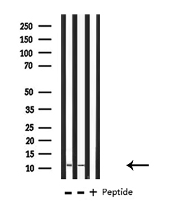 S100A10 Antibody - Western blot analysis of S100 A10 expression in various lysates