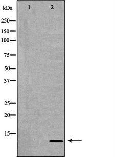 S100A10 Antibody - Western blot analysis of SW480 cell lysates using S100A10 antibody. The lane on the left is treated with the antigen-specific peptide.