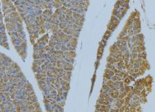 S100A10 Antibody - 1:100 staining human pancreas tissue by IHC-P. The sample was formaldehyde fixed and a heat mediated antigen retrieval step in citrate buffer was performed. The sample was then blocked and incubated with the antibody for 1.5 hours at 22°C. An HRP conjugated goat anti-rabbit antibody was used as the secondary.
