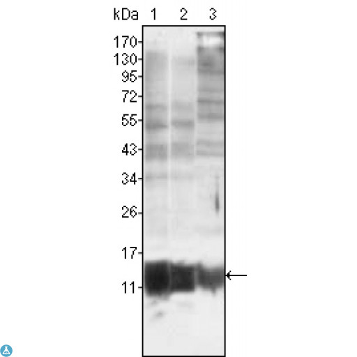S100A10 Antibody - Western Blot (WB) analysis using S-100A10 Monoclonal Antibody against MCF-7 (1), HepG2 (2) and HeLa (3).