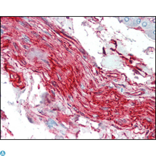 S100A10 Antibody - Immunohistochemistry (IHC) analysis of paraffin-embedded human nerve and ganglion cells with AEC staining using S-100A10 Monoclonal Antibody.