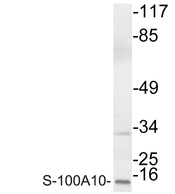 S100A10 Antibody - Western blot of S-100A10 (V52) pAb in extracts from COLO cells.