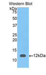 S100A12 Antibody - Western blot of recombinant S100A12 / CGRP.  This image was taken for the unconjugated form of this product. Other forms have not been tested.