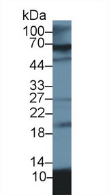 S100A12 Antibody - Western Blot; Sample: Porcine Lung lysate; Primary Ab: 2µg/ml Rabbit Anti-Porcine S100A12 Antibody Second Ab: 0.2µg/mL HRP-Linked Caprine Anti-Rabbit IgG Polyclonal Antibody