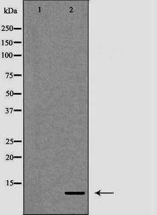 S100A12 Antibody - Western blot analysis of K562 cell lysates using S100A12 antibody. The lane on the left is treated with the antigen-specific peptide.