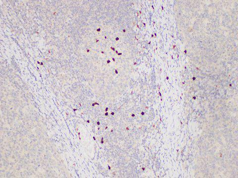 S100A12 Antibody - Immunohistochemistry of paraffin-embedded Human tonsil using S100A12 Polycloanl Antibody at dilution of 1:85.