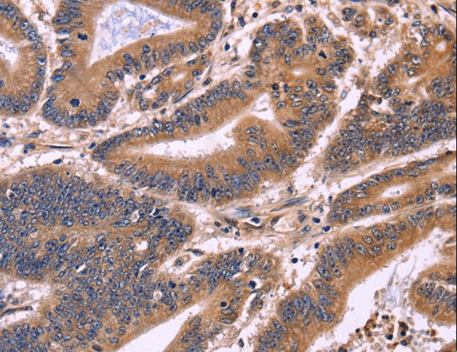 S100A13 Antibody - Immunohistochemistry of paraffin-embedded Human brain using S100A13 Polyclonal Antibody at dilution of 1:40.