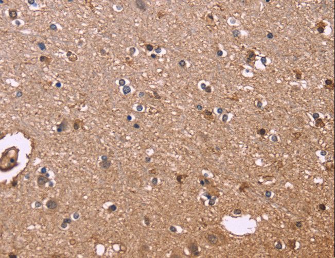 S100A13 Antibody - Immunohistochemistry of paraffin-embedded Human brain using S100A13 Polyclonal Antibody at dilution of 1:40.