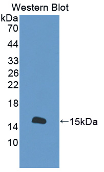 S100A16 Antibody - Western blot of S100A16 antibody.