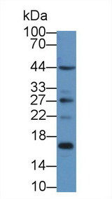 S100A16 Antibody - Western Blot; Sample: Rat Stomach lysate; Primary Ab: 1µg/ml Rabbit Anti-Rat S100A16 Antibody Second Ab: 0.2µg/mL HRP-Linked Caprine Anti-Rabbit IgG Polyclonal Antibody