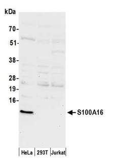 S100A16 Antibody - Detection of human S100A16 by western blot. Samples: Whole cell lysate (50 µg) from HeLa, HEK293T, and Jurkat cells prepared using NETN lysis buffer. Antibody: Affinity purified rabbit anti-S100A16 antibody used for WB at 1:1000. Detection: Chemiluminescence with an exposure time of 30 seconds.