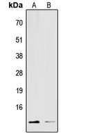 S100A16 Antibody - Western blot analysis of S100-A16 expression in HEK293T (A); Raw264.7 (B) whole cell lysates.