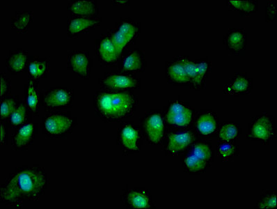 S100A16 Antibody - Immunofluorescent analysis of MCF-7 cells using S100A16 Antibody at dilution of 1:100 and Alexa Fluor 488-congugated AffiniPure Goat Anti-Rabbit IgG(H+L)